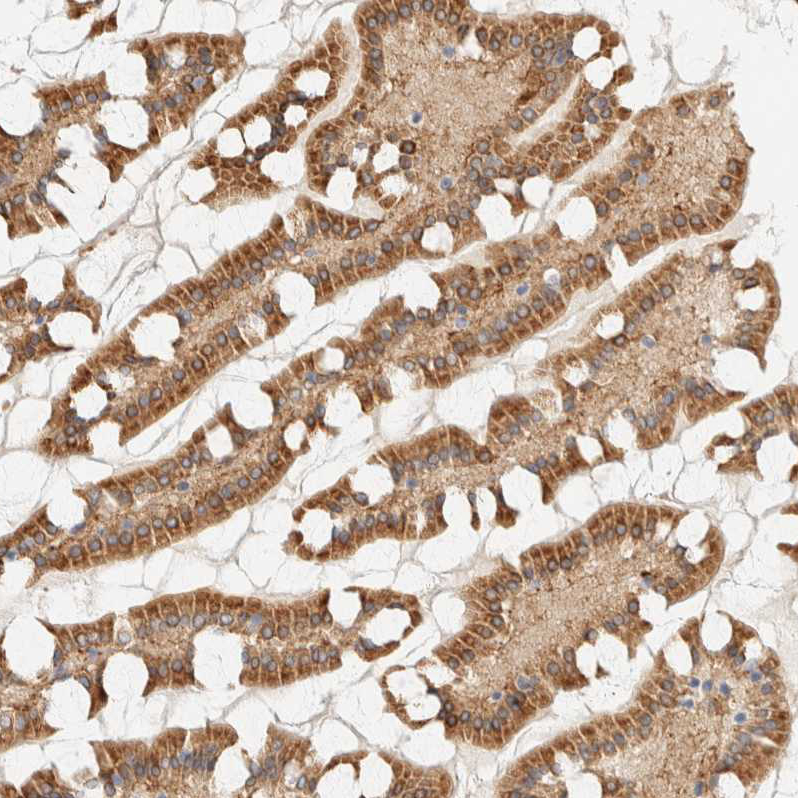 NT5C Antibody - BSA Free Immunohistochemistry-Paraffin: NT5C Antibody - BSA Free [NBP1-84563]