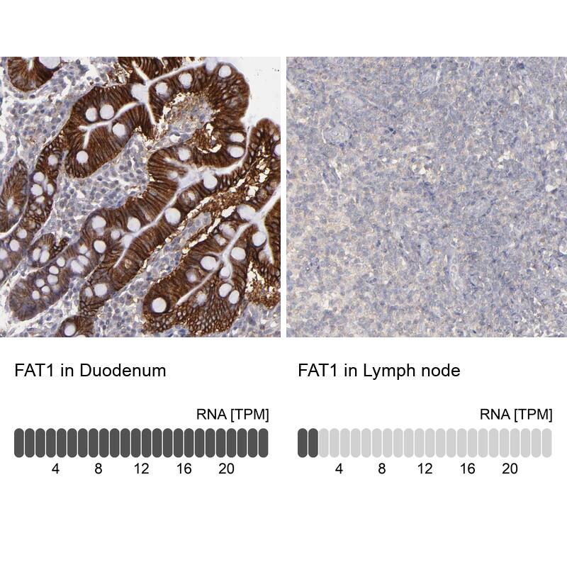 FAT1 Antibody - BSA Free Immunohistochemistry-Paraffin: FAT1 Antibody - BSA Free [NBP1-84566]