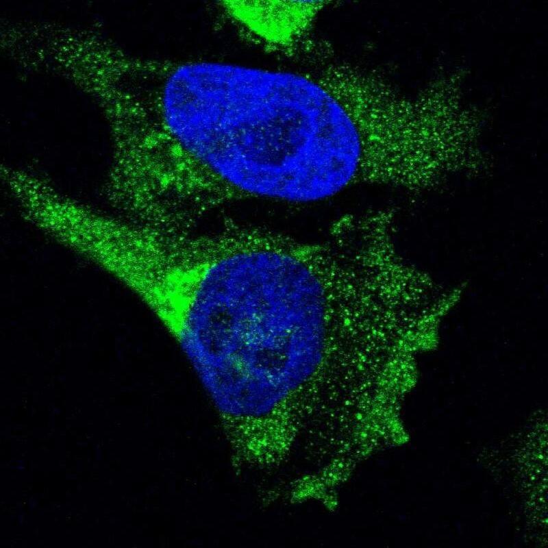 Ret Antibody - BSA Free Immunocytochemistry/ Immunofluorescence: Ret Antibody [NBP1-84568]