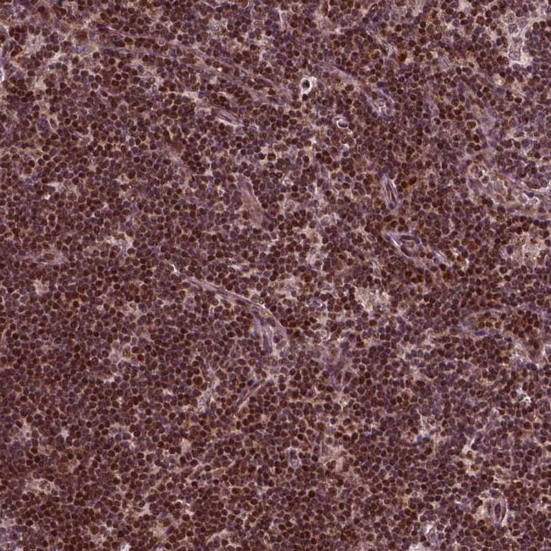 Cdc14A Antibody - BSA Free Immunohistochemistry-Paraffin: Cdc14A Antibody - BSA Free [NBP1-84573]