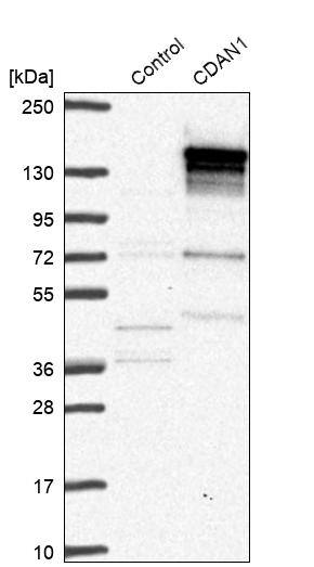 CDAN1 Antibody - BSA Free Western Blot: CDAN1 Antibody - BSA Free [NBP1-84574]