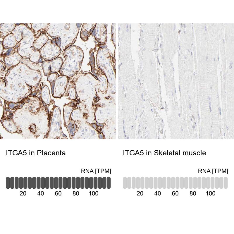 Integrin alpha 5/CD49e Antibody - BSA Free Immunohistochemistry-Paraffin: Integrin alpha 5/CD49e Antibody [NBP1-84576]