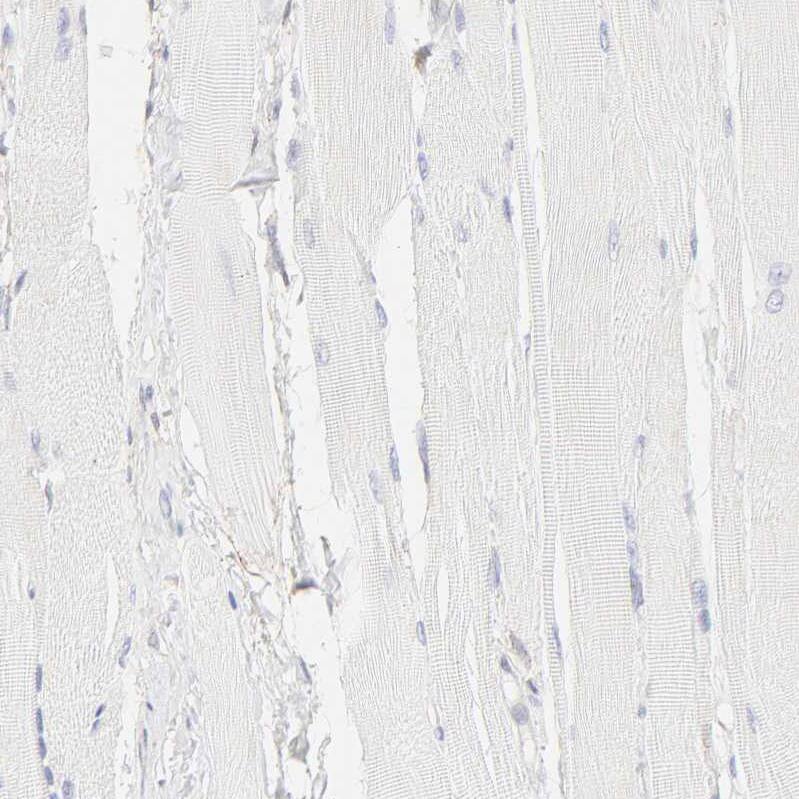 Integrin alpha 5/CD49e Antibody - BSA Free Immunohistochemistry-Paraffin: Integrin alpha 5/CD49e Antibody [NBP1-84576]