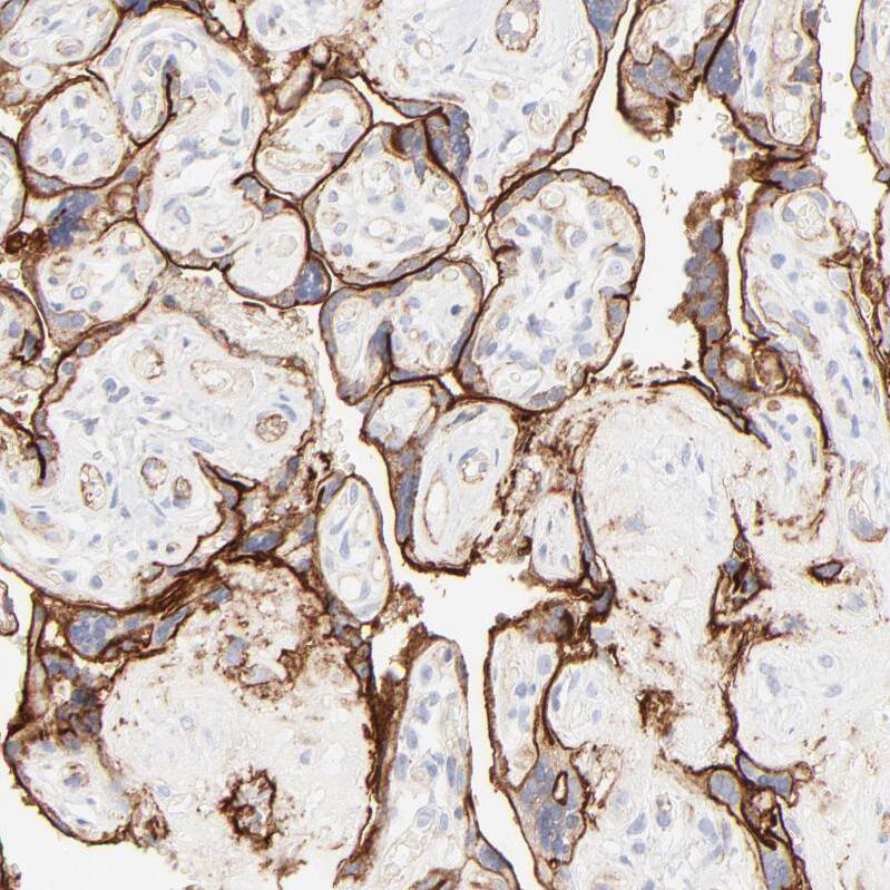 Integrin alpha 5/CD49e Antibody - BSA Free Immunohistochemistry-Paraffin: Integrin alpha 5/CD49e Antibody [NBP1-84576]