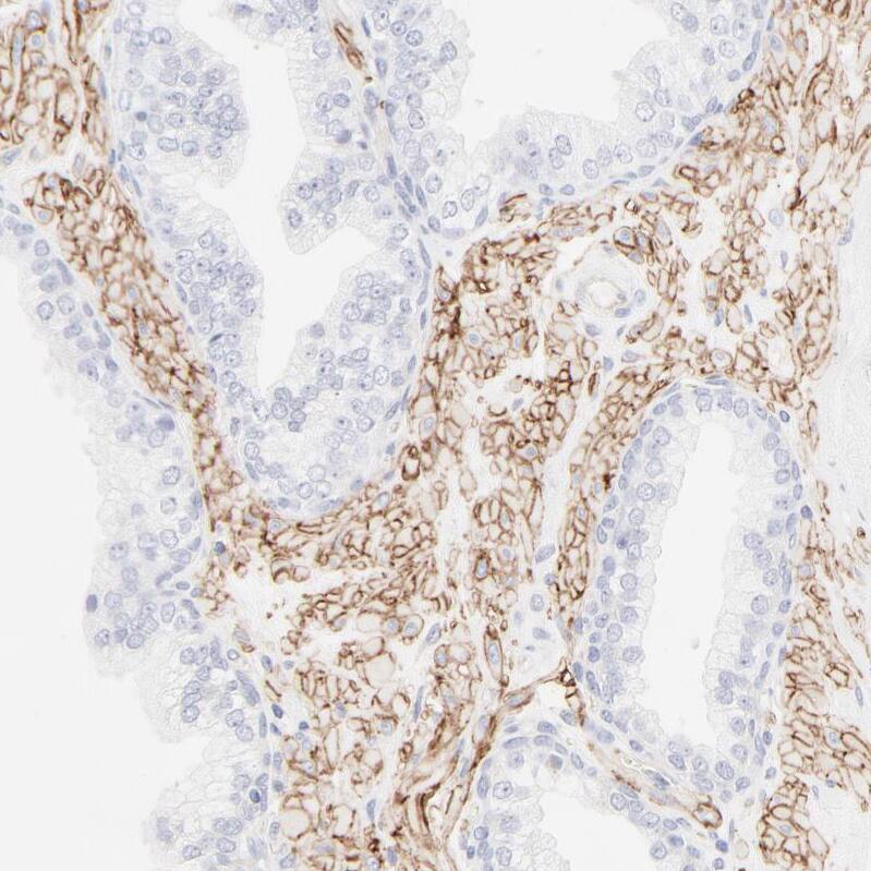 Integrin alpha 5/CD49e Antibody - BSA Free Immunohistochemistry-Paraffin: Integrin alpha 5/CD49e Antibody [NBP1-84576]