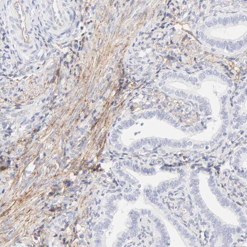 Integrin alpha 5/CD49e Antibody - BSA Free Immunohistochemistry-Paraffin: Integrin alpha 5/CD49e Antibody [NBP1-84576]