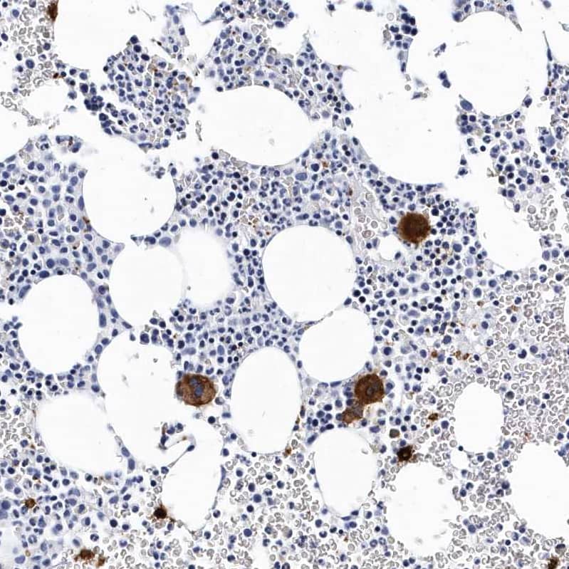 Integrin alpha 2b/CD41 Antibody - BSA Free Immunohistochemistry-Paraffin: Integrin alpha 2b/CD41 Antibody - BSA Free [NBP1-84579]