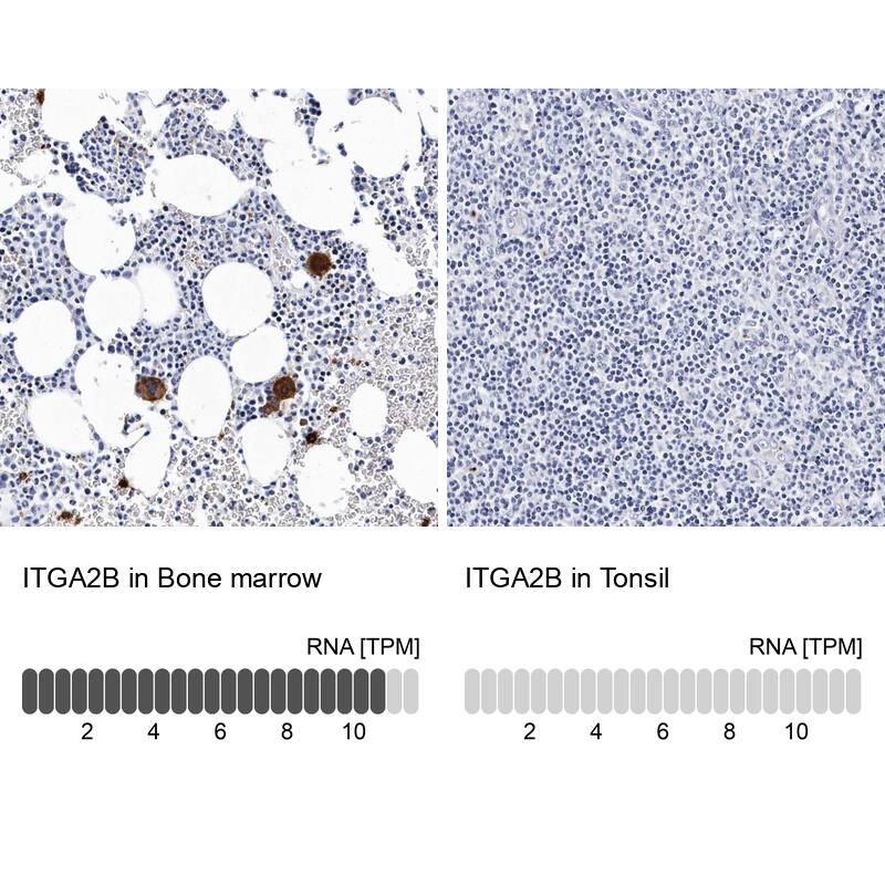 Integrin alpha 2b/CD41 Antibody - BSA Free Immunohistochemistry-Paraffin: Integrin alpha 2b/CD41 Antibody - BSA Free [NBP1-84579]