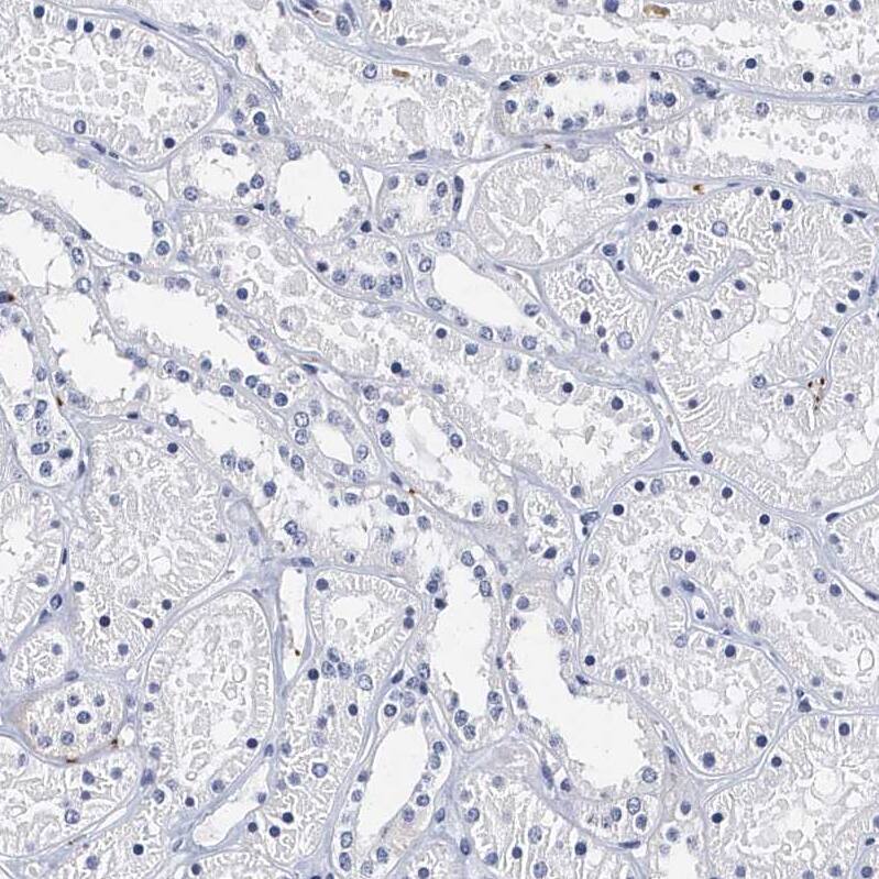 Integrin alpha 2b/CD41 Antibody - BSA Free Immunohistochemistry-Paraffin: Integrin alpha 2b/CD41 Antibody - BSA Free [NBP1-84579]