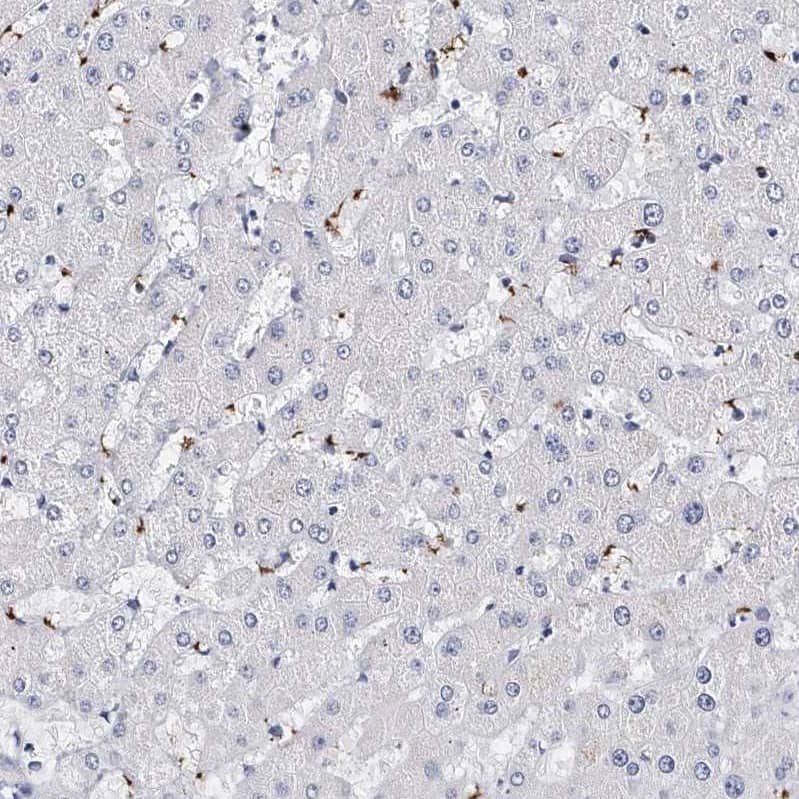 Integrin alpha 2b/CD41 Antibody - BSA Free Immunohistochemistry-Paraffin: Integrin alpha 2b/CD41 Antibody - BSA Free [NBP1-84579]