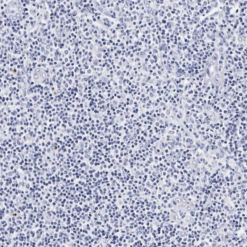 Integrin alpha 2b/CD41 Antibody - BSA Free Immunohistochemistry-Paraffin: Integrin alpha 2b/CD41 Antibody - BSA Free [NBP1-84579]