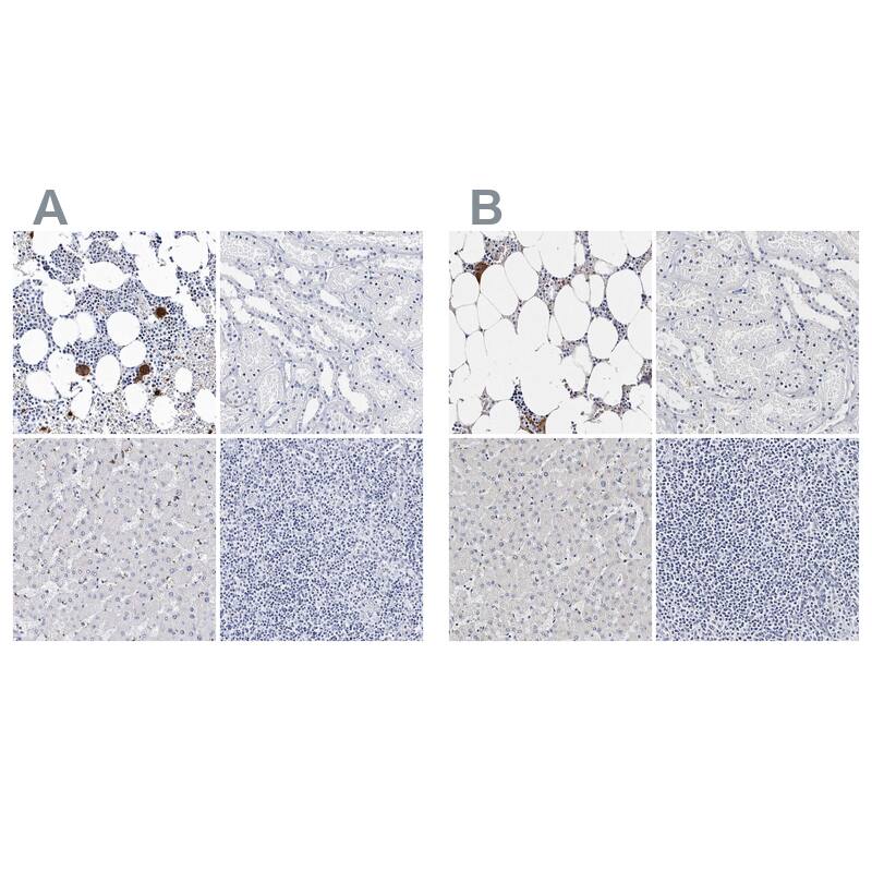 Integrin alpha 2b/CD41 Antibody - BSA Free Immunohistochemistry-Paraffin: Integrin alpha 2b/CD41 Antibody - BSA Free [NBP1-84579]