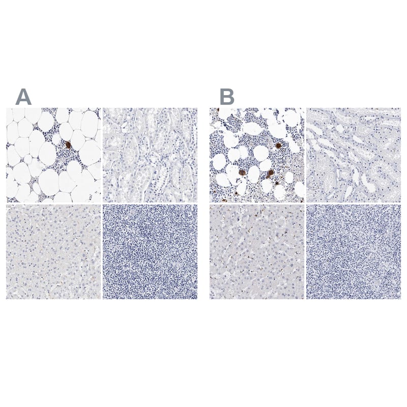 Integrin alpha 2b/CD41 Antibody - BSA Free Immunohistochemistry-Paraffin: Integrin alpha 2b/CD41 Antibody - BSA Free [NBP1-84580]