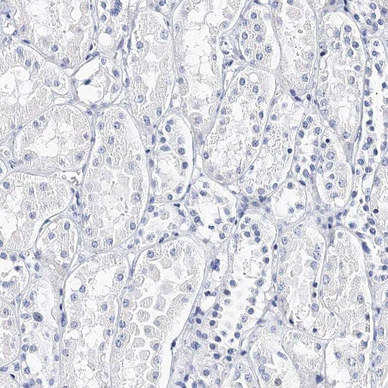 Integrin alpha 2b/CD41 Antibody - BSA Free Immunohistochemistry-Paraffin: Integrin alpha 2b/CD41 Antibody - BSA Free [NBP1-84580]