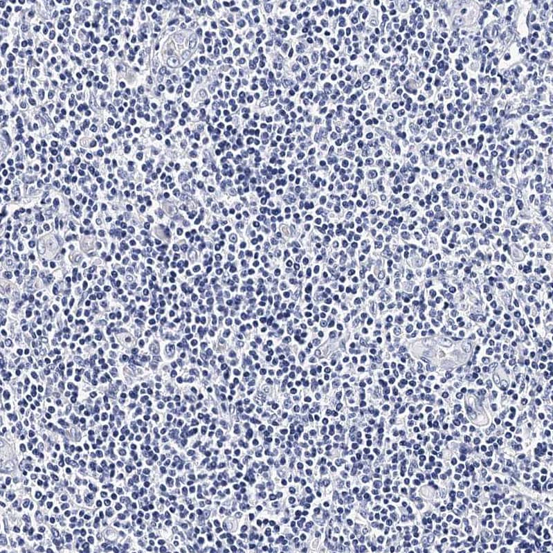 Integrin alpha 2b/CD41 Antibody - BSA Free Immunohistochemistry-Paraffin: Integrin alpha 2b/CD41 Antibody - BSA Free [NBP1-84580]