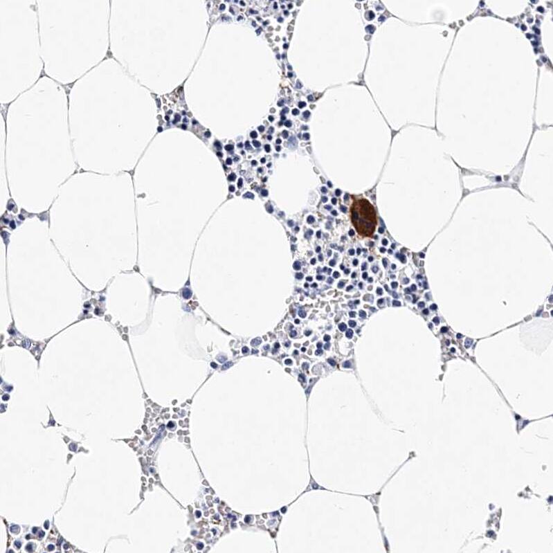 Integrin alpha 2b/CD41 Antibody - BSA Free Immunohistochemistry-Paraffin: Integrin alpha 2b/CD41 Antibody - BSA Free [NBP1-84580]