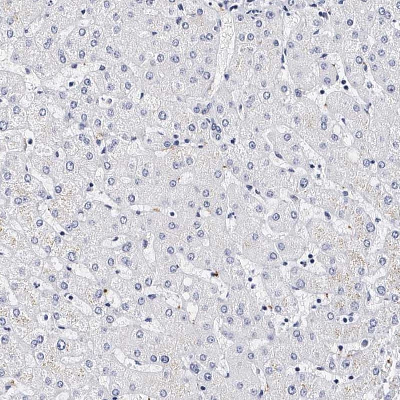 Integrin alpha 2b/CD41 Antibody - BSA Free Immunohistochemistry-Paraffin: Integrin alpha 2b/CD41 Antibody - BSA Free [NBP1-84581]