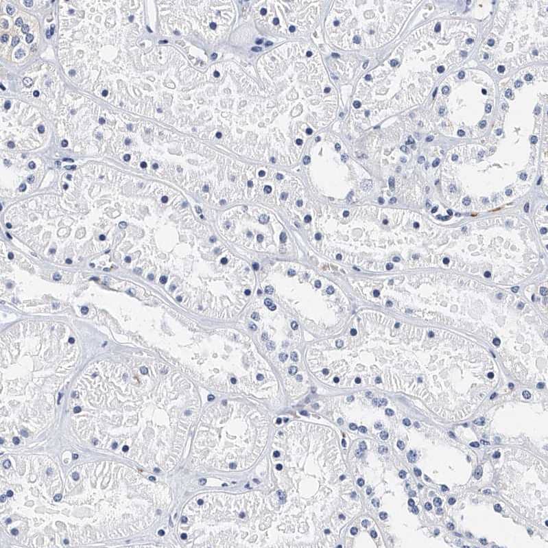 Integrin alpha 2b/CD41 Antibody - BSA Free Immunohistochemistry-Paraffin: Integrin alpha 2b/CD41 Antibody - BSA Free [NBP1-84581]