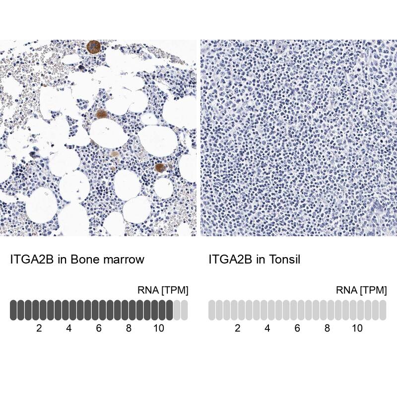 Integrin alpha 2b/CD41 Antibody - BSA Free Immunohistochemistry-Paraffin: Integrin alpha 2b/CD41 Antibody - BSA Free [NBP1-84581]