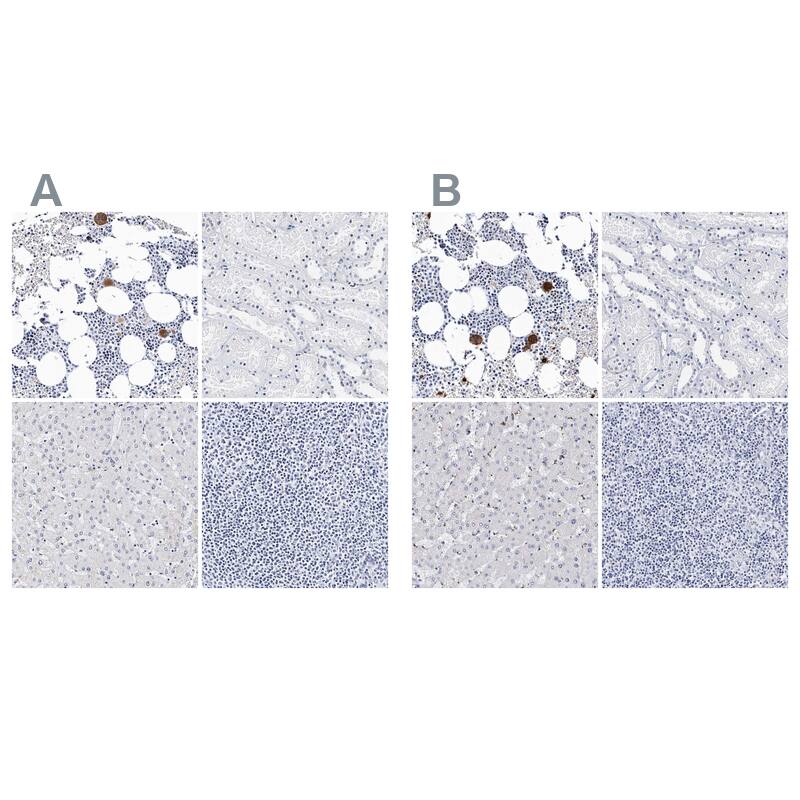 Integrin alpha 2b/CD41 Antibody - BSA Free Immunohistochemistry-Paraffin: Integrin alpha 2b/CD41 Antibody - BSA Free [NBP1-84581]