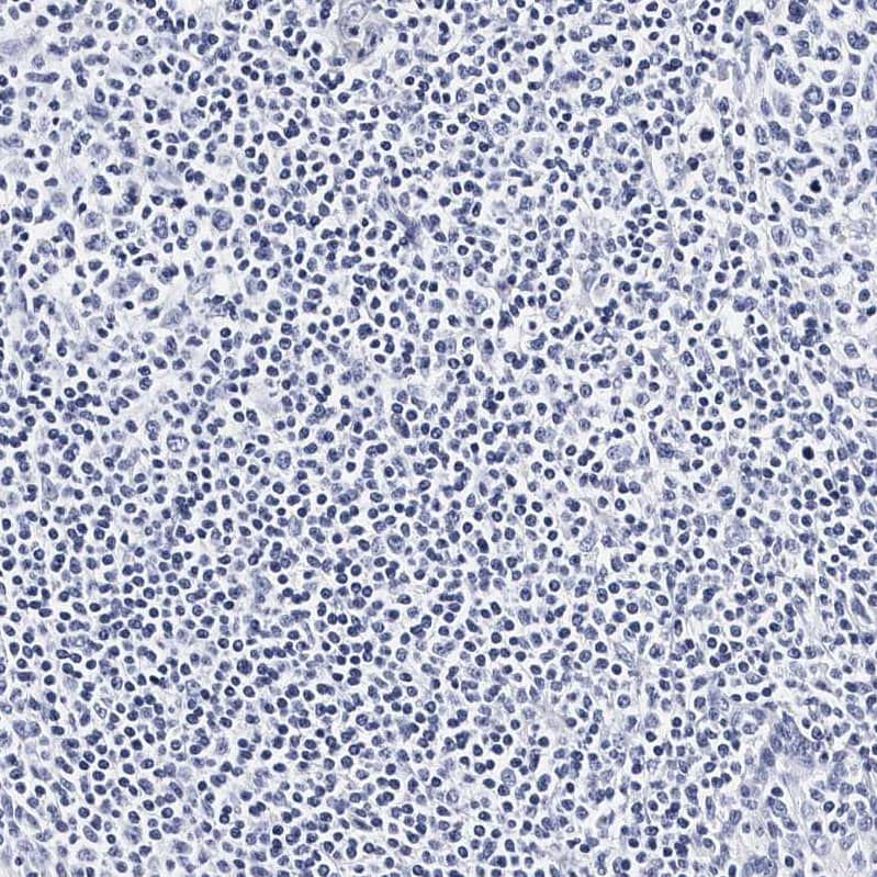 Integrin alpha 2b/CD41 Antibody - BSA Free Immunohistochemistry-Paraffin: Integrin alpha 2b/CD41 Antibody - BSA Free [NBP1-84581]