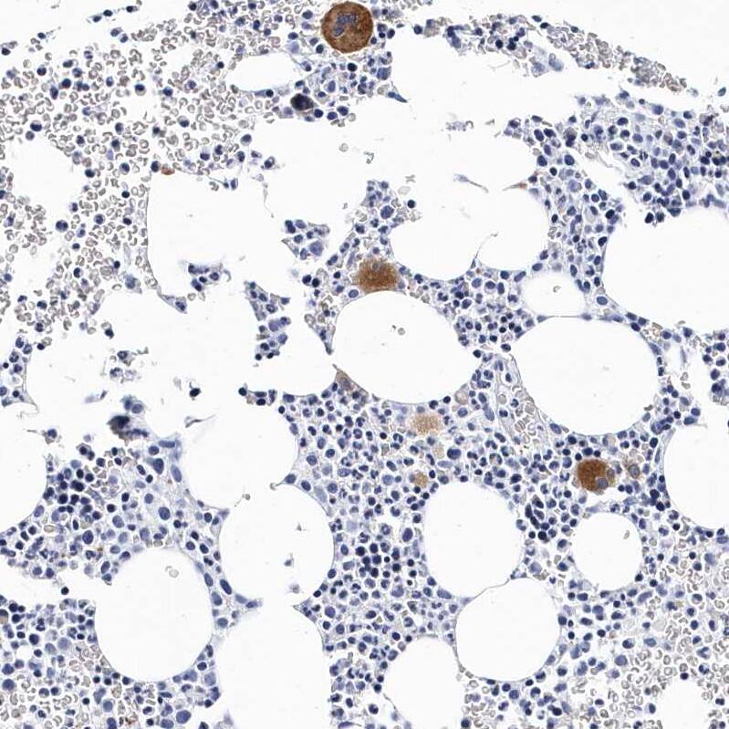 Integrin alpha 2b/CD41 Antibody - BSA Free Immunohistochemistry-Paraffin: Integrin alpha 2b/CD41 Antibody - BSA Free [NBP1-84581]