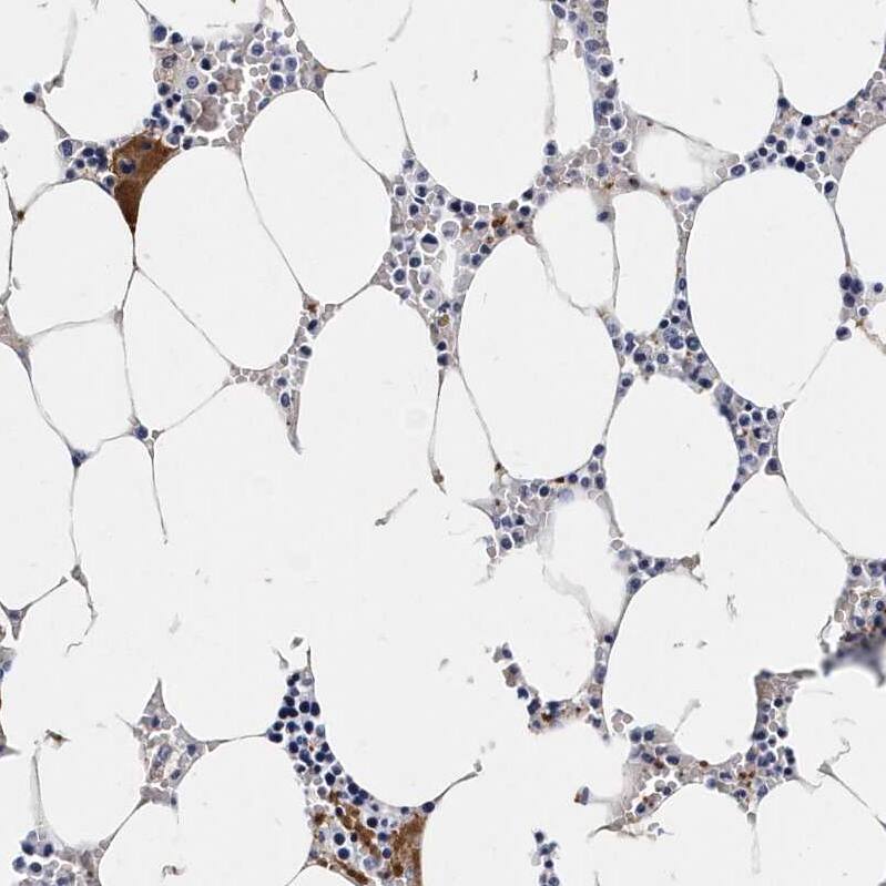 Integrin alpha 2b/CD41 Antibody - BSA Free Immunohistochemistry-Paraffin: Integrin alpha 2b/CD41 Antibody - BSA Free [NBP1-84582]
