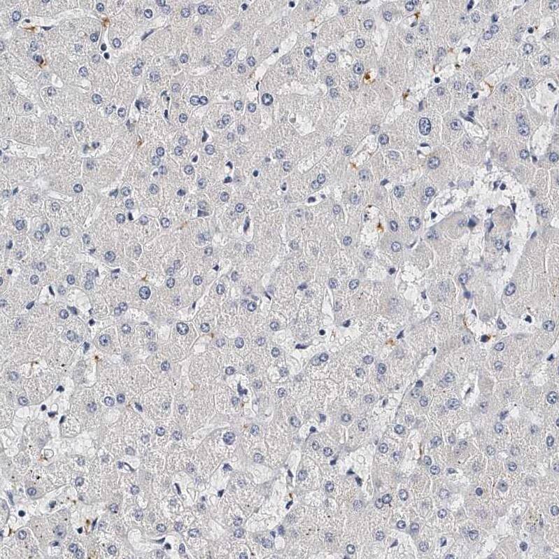 Integrin alpha 2b/CD41 Antibody - BSA Free Immunohistochemistry-Paraffin: Integrin alpha 2b/CD41 Antibody - BSA Free [NBP1-84582]