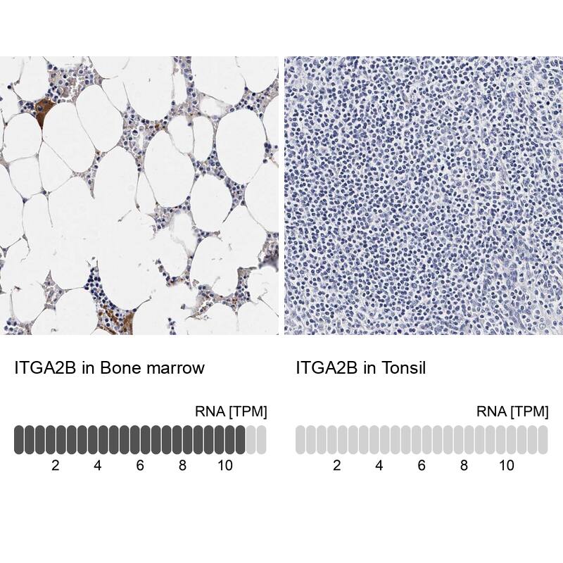 Integrin alpha 2b/CD41 Antibody - BSA Free Immunohistochemistry-Paraffin: Integrin alpha 2b/CD41 Antibody - BSA Free [NBP1-84582]