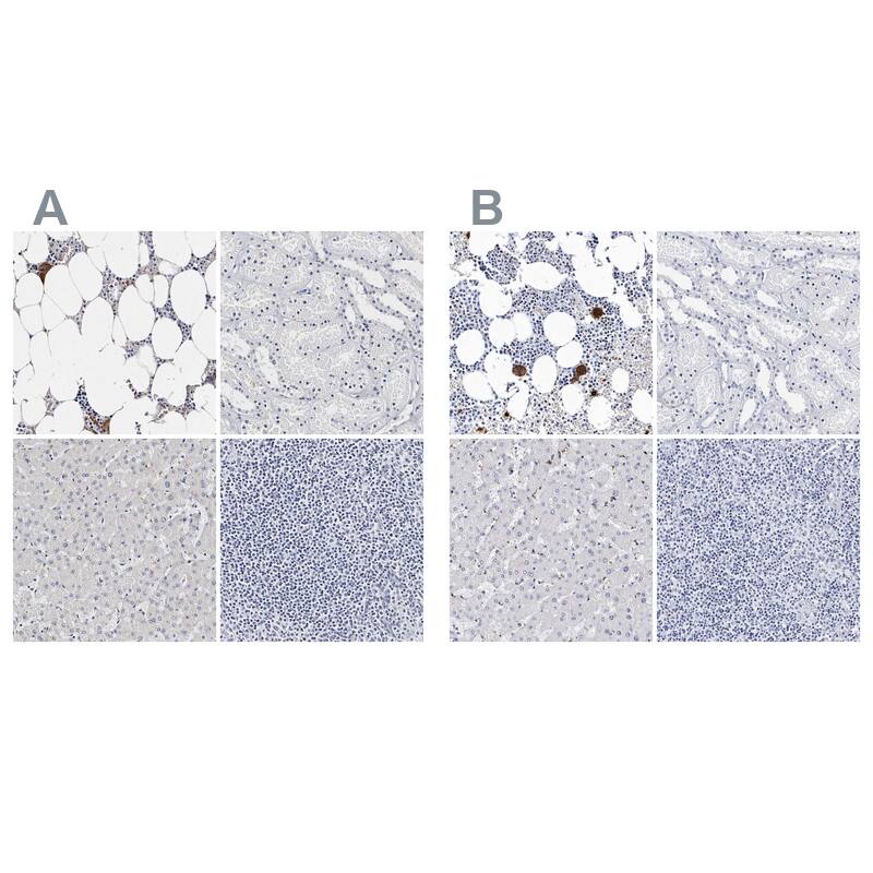 Integrin alpha 2b/CD41 Antibody - BSA Free Immunohistochemistry-Paraffin: Integrin alpha 2b/CD41 Antibody - BSA Free [NBP1-84582]