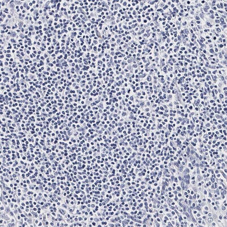 Integrin alpha 2b/CD41 Antibody - BSA Free Immunohistochemistry-Paraffin: Integrin alpha 2b/CD41 Antibody - BSA Free [NBP1-84582]