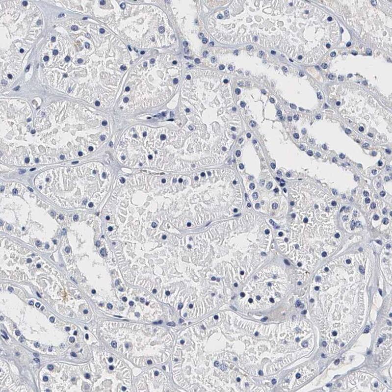 Integrin alpha 2b/CD41 Antibody - BSA Free Immunohistochemistry-Paraffin: Integrin alpha 2b/CD41 Antibody - BSA Free [NBP1-84582]