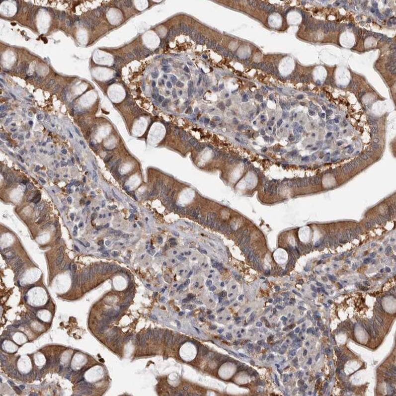 FGFR4 Antibody - BSA Free Immunohistochemistry-Paraffin: FGFR4 Antibody - BSA Free [NBP1-84585]