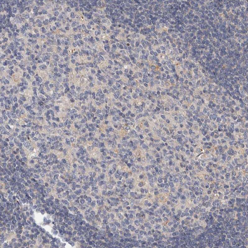 FGFR4 Antibody - BSA Free Immunohistochemistry-Paraffin: FGFR4 Antibody - BSA Free [NBP1-84585]
