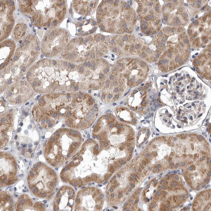 FGFR4 Antibody - BSA Free Immunohistochemistry-Paraffin: FGFR4 Antibody - BSA Free [NBP1-84587]