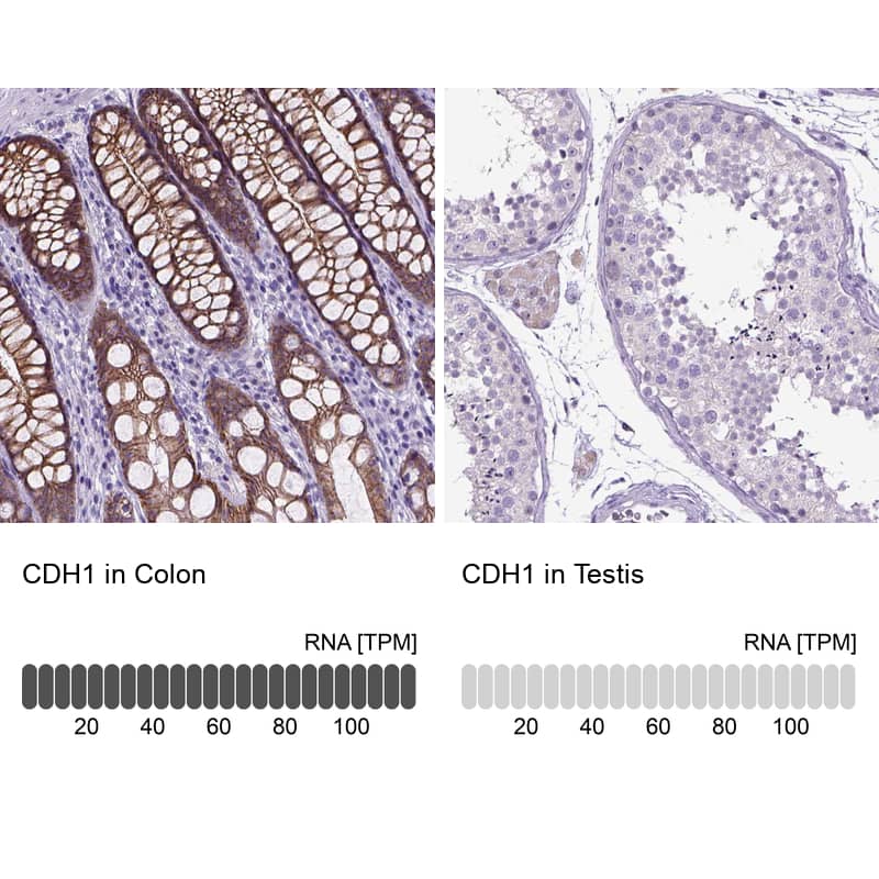E-Cadherin Antibody - BSA Free Immunohistochemistry-Paraffin: E-Cadherin Antibody - BSA Free [NBP1-84588]