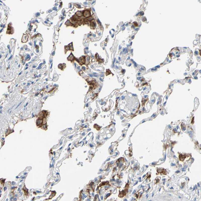 Fc gamma RIIA/CD32a Antibody - BSA Free Immunohistochemistry-Paraffin: Fc gamma RIIA/CD32a Antibody - BSA Free [NBP1-84589]