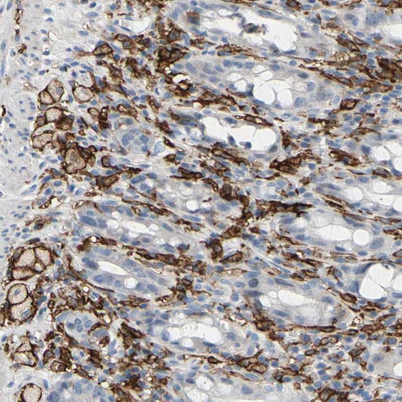 Fc gamma RIIA/CD32a Antibody - BSA Free Immunohistochemistry-Paraffin: Fc gamma RIIA/CD32a Antibody - BSA Free [NBP1-84589]