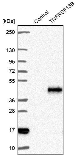 TACI/TNFRSF13B/CVID Antibody - BSA Free Western Blot: TACI/TNFRSF13B/CVID Antibody - BSA Free [NBP1-84596]