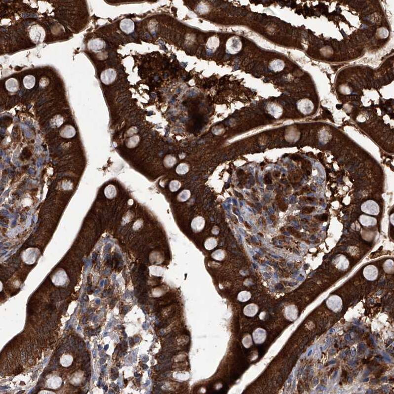 TACI/TNFRSF13B/CVID Antibody - BSA Free Immunohistochemistry-Paraffin: TACI/TNFRSF13B/CVID Antibody - BSA Free [NBP1-84596]