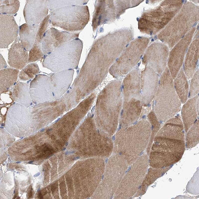 TACI/TNFRSF13B/CVID Antibody - BSA Free Immunohistochemistry-Paraffin: TACI/TNFRSF13B/CVID Antibody - BSA Free [NBP1-84596]