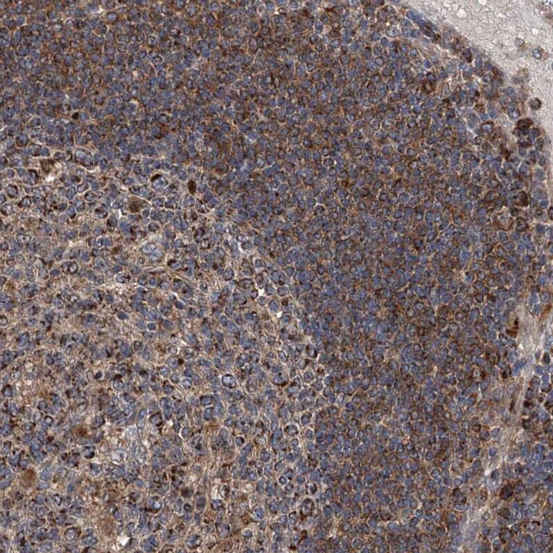 TACI/TNFRSF13B/CVID Antibody - BSA Free Immunohistochemistry-Paraffin: TACI/TNFRSF13B/CVID Antibody - BSA Free [NBP1-84596]