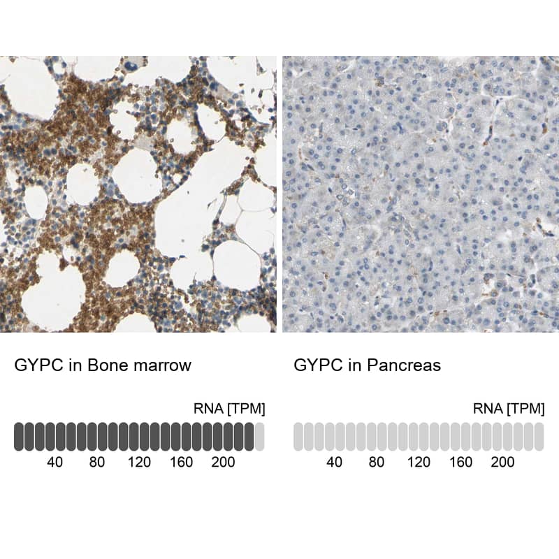 Glycophorin C Antibody - BSA Free Immunohistochemistry-Paraffin: Glycophorin C Antibody [NBP1-84597]
