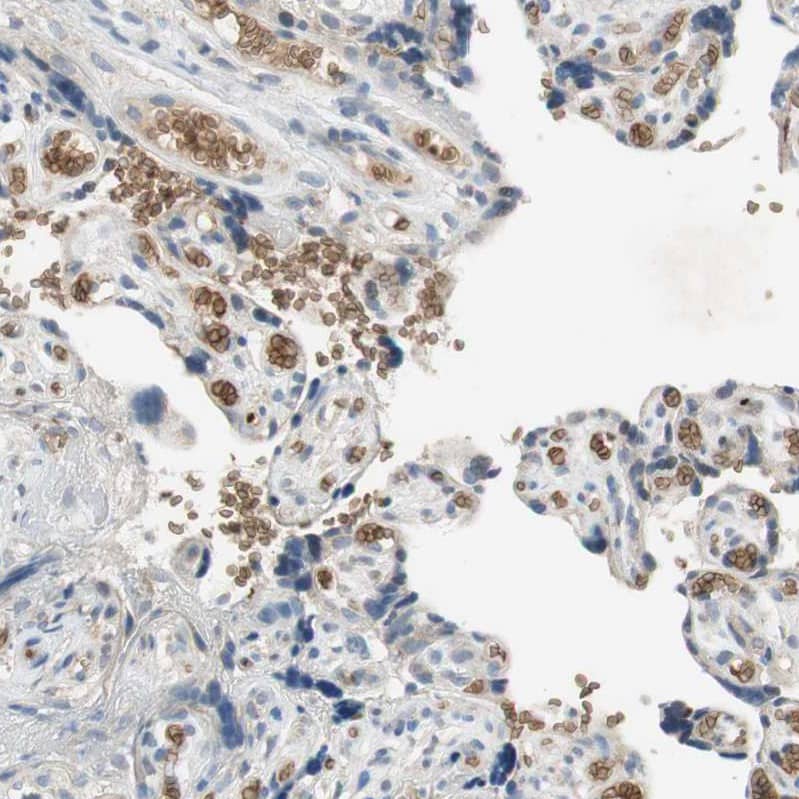 Glycophorin C Antibody - BSA Free Immunohistochemistry-Paraffin: Glycophorin C Antibody [NBP1-84597]