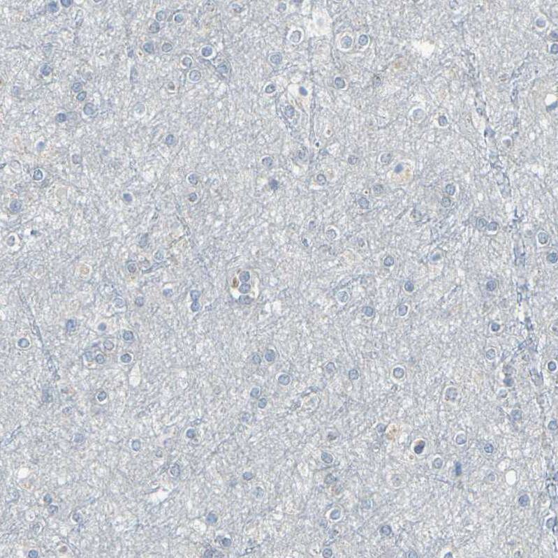 Glycophorin C Antibody - BSA Free Immunohistochemistry-Paraffin: Glycophorin C Antibody [NBP1-84597]