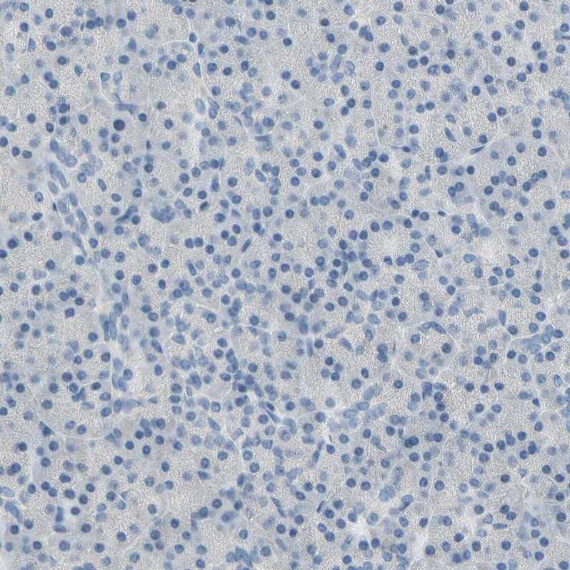CKAP2 Antibody - BSA Free Immunohistochemistry-Paraffin: CKAP2 Antibody - BSA Free [NBP1-84602]