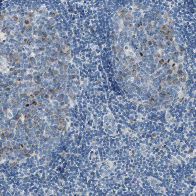 CKAP2 Antibody - BSA Free Immunohistochemistry-Paraffin: CKAP2 Antibody - BSA Free [NBP1-84602]