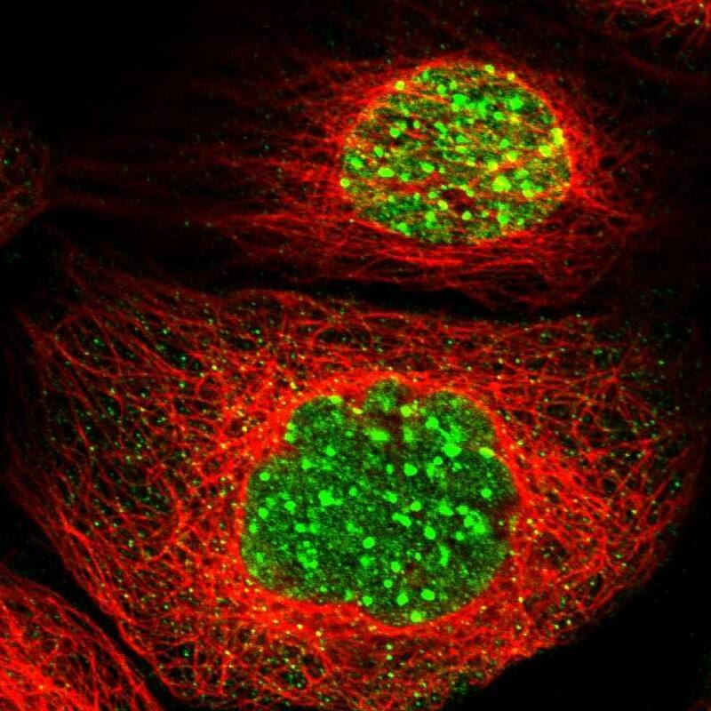 MCAF1 Antibody - BSA Free Immunocytochemistry/ Immunofluorescence: MCAF1 Antibody [NBP1-84610]