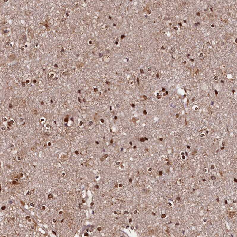 GNL3L Antibody - BSA Free Immunohistochemistry-Paraffin: GNL3L Antibody - BSA Free [NBP1-84618]