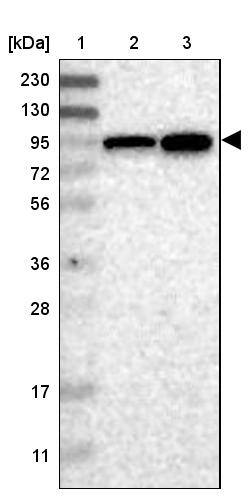 ELAC2 Antibody - BSA Free Western Blot: ELAC2 Antibody - BSA Free [NBP1-84620]